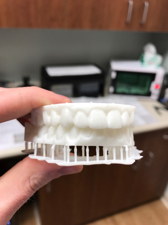 saddle creek ortho memphis invisalign braces 3d printing scanner