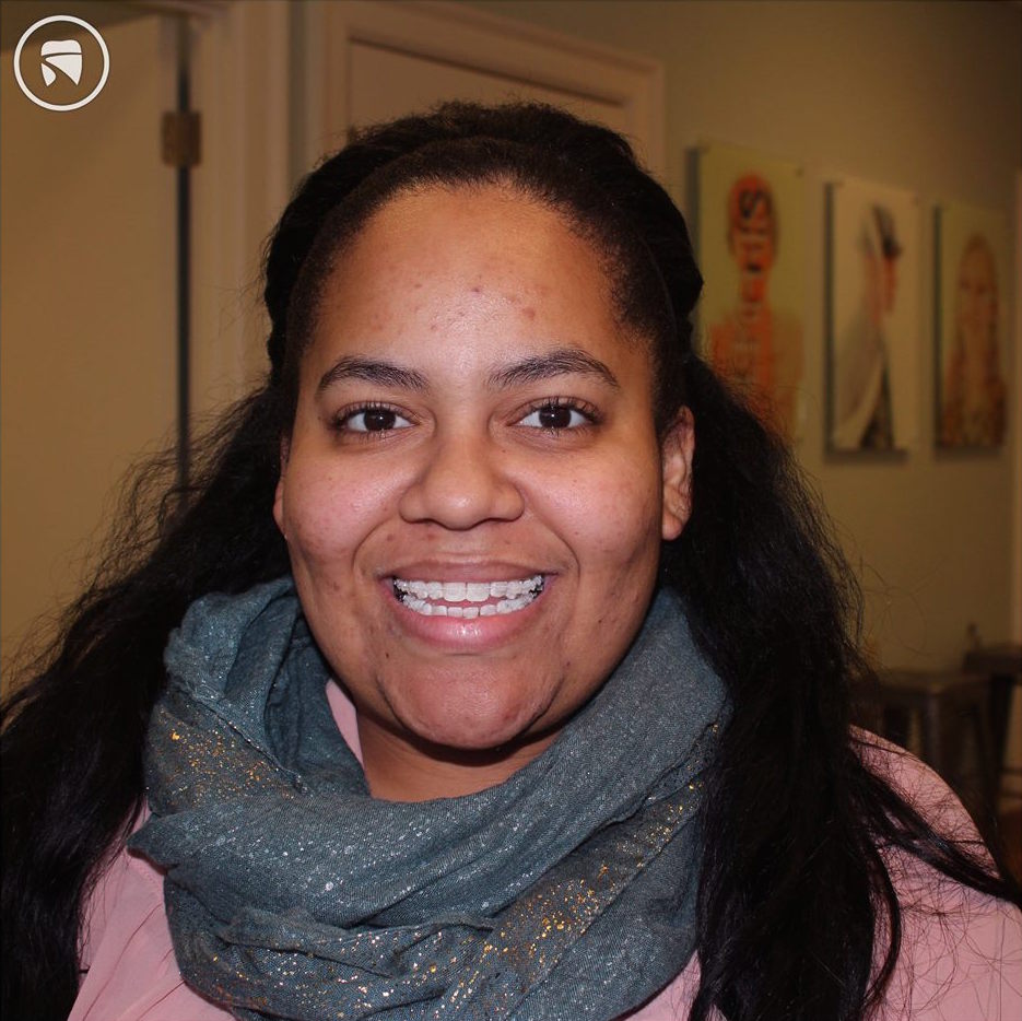 Adult Ceramic Braces | Memphis Braces | Orthodontics for Adults