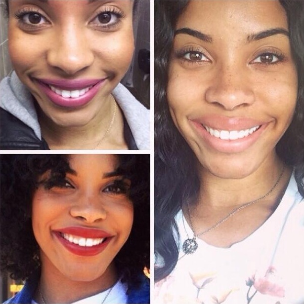 Alondra Before and After Invisalign | Patient Wearing Invisalign | Saddle Creek Orthodontics