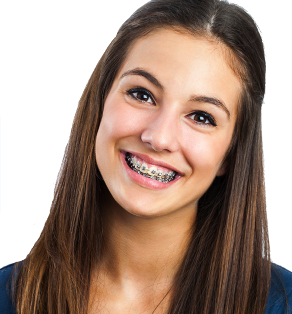 eating with braces | braces friendly foods | Saddle Creek Orthodontics