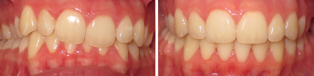 Memphis Orthodontist | Saddle Creek