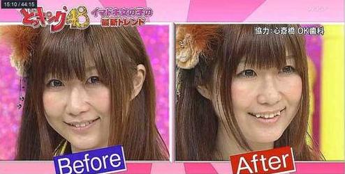 DIY Orthodontics | Saddle Creek Orthodontics | Memphis Orthodontics