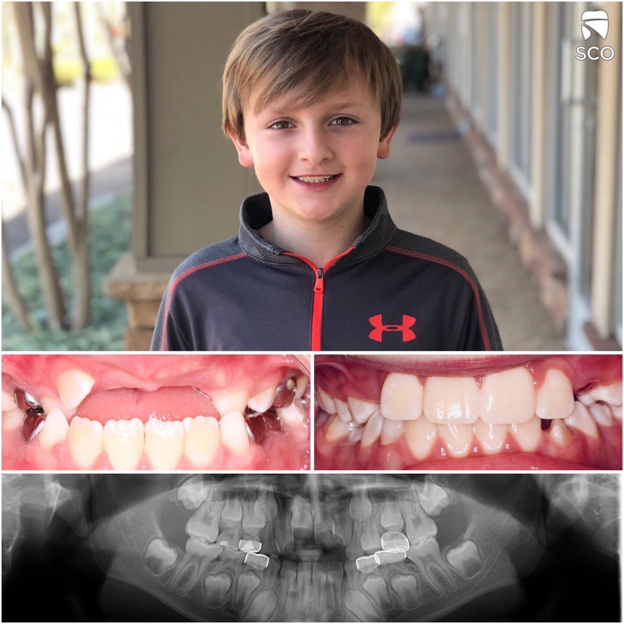 young patient before and after photo