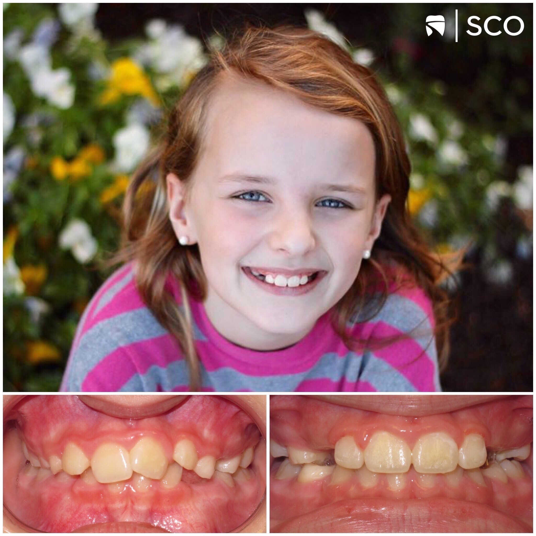 young patient before and after photo