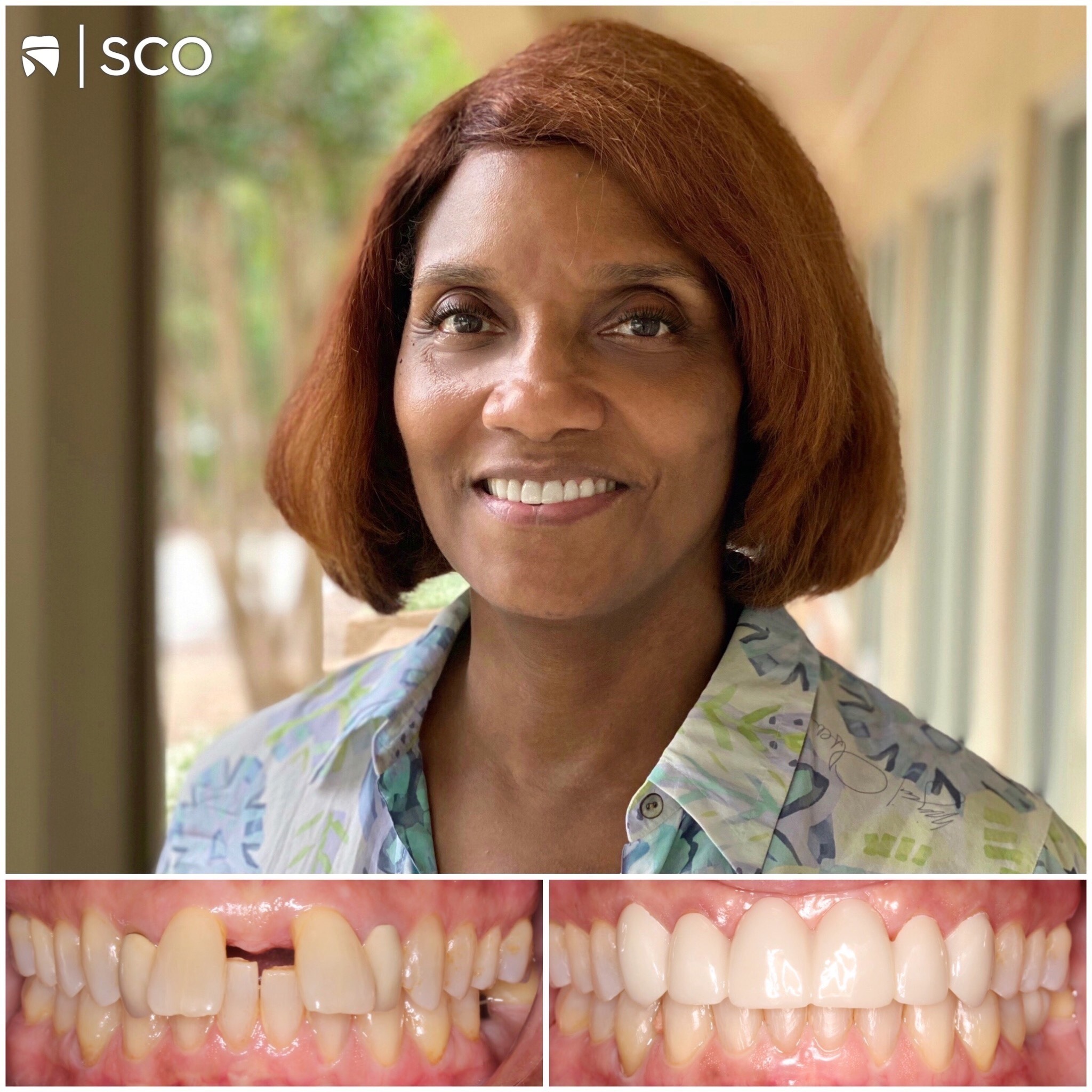 patient before and after photo