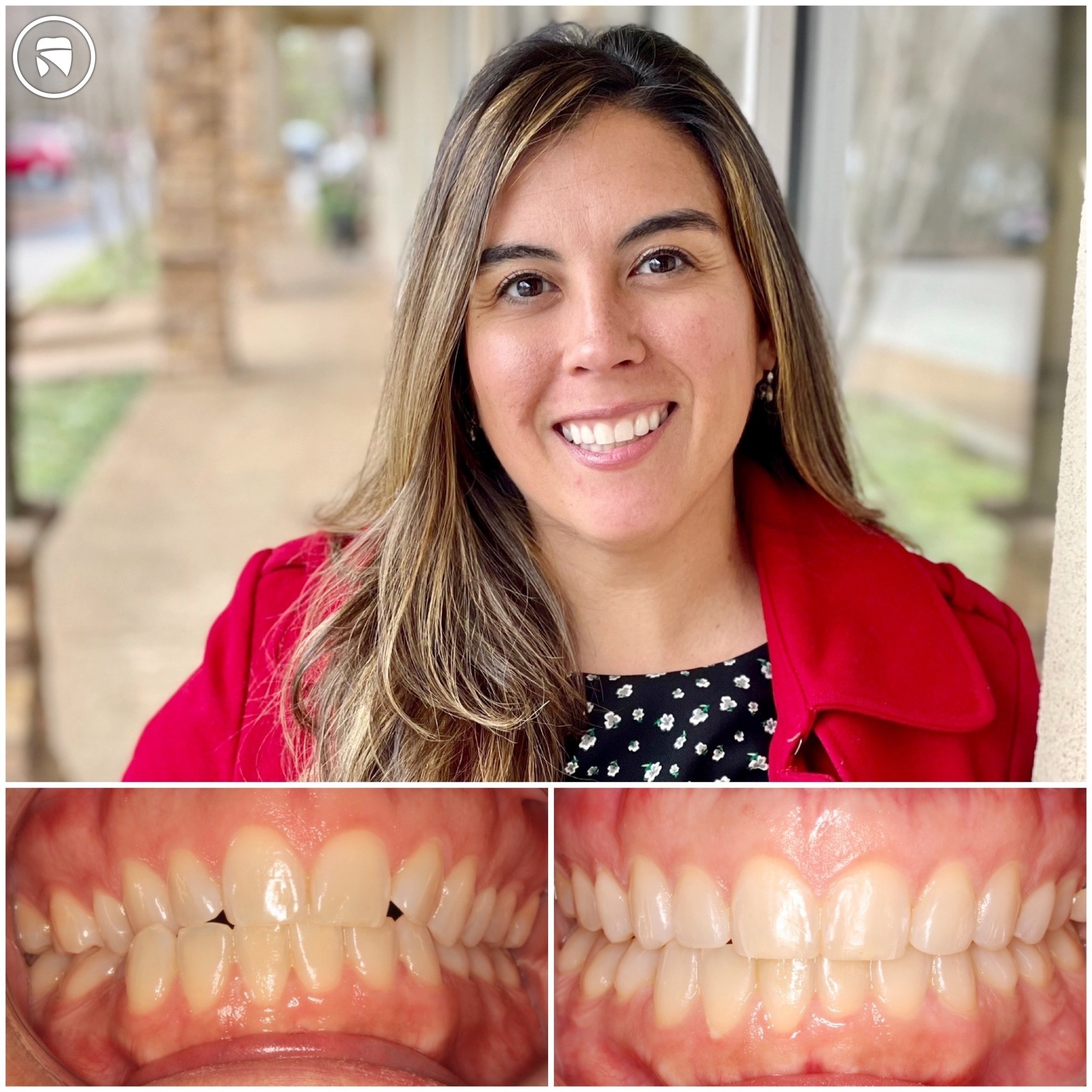 patient before and after photo