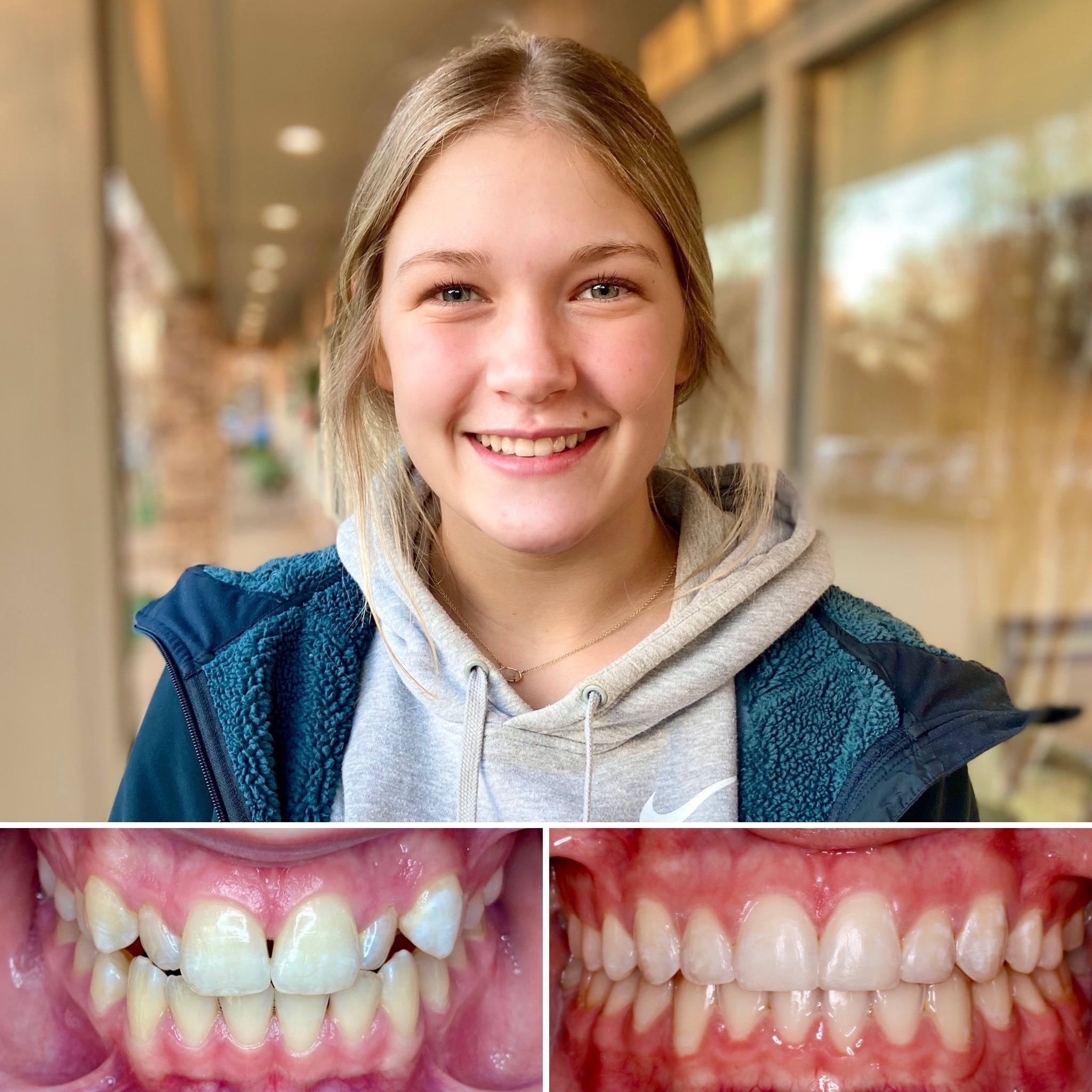 patient before and after photo