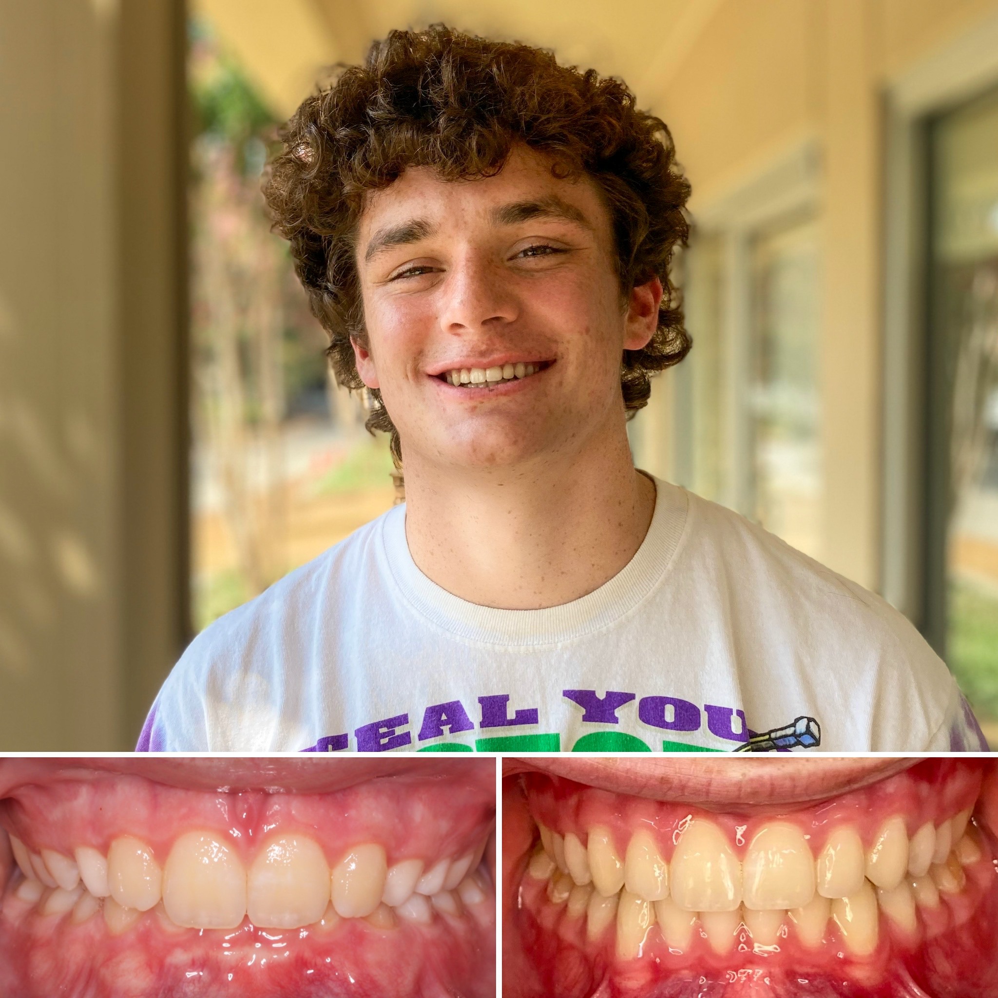 patient before and after photo