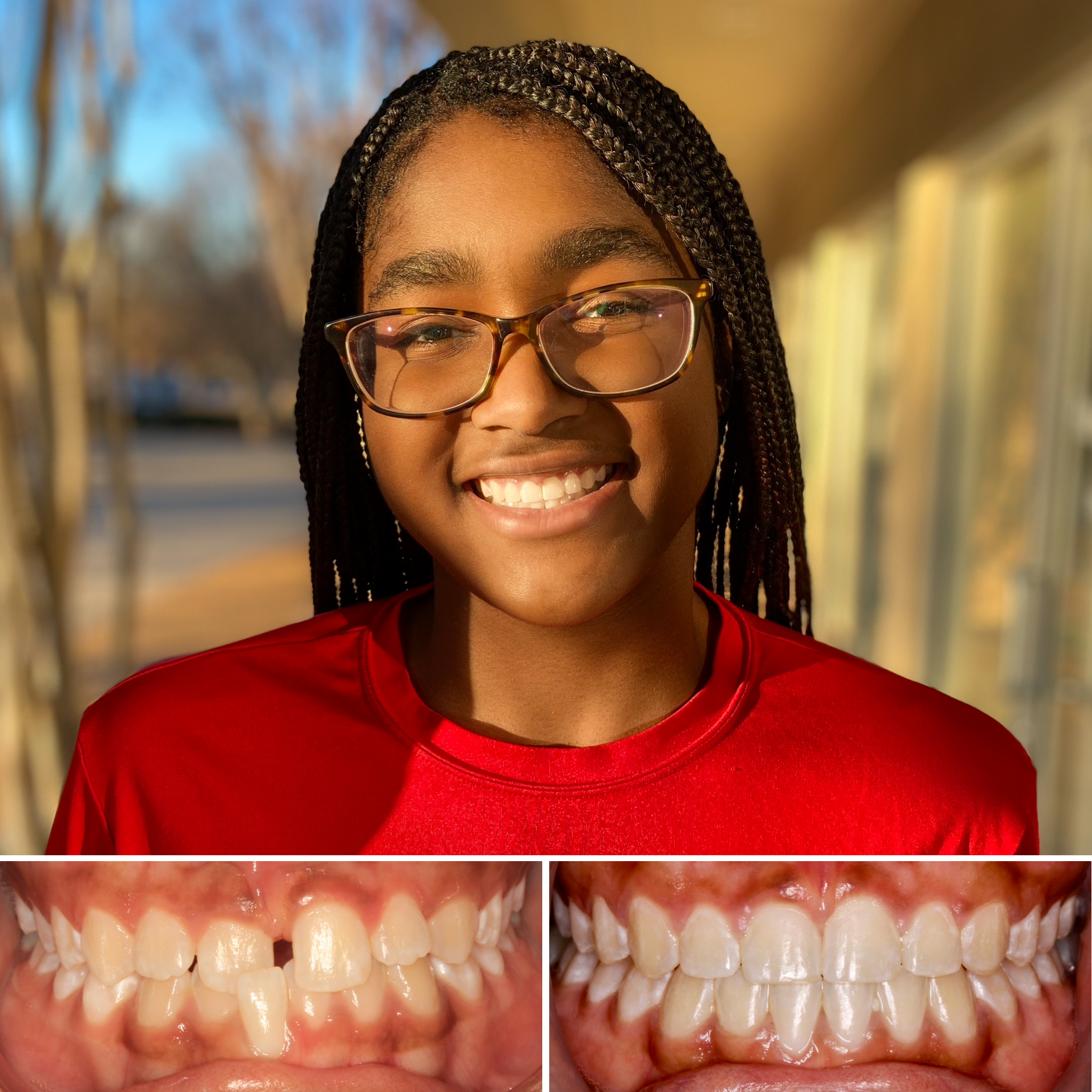 patient before and after photo