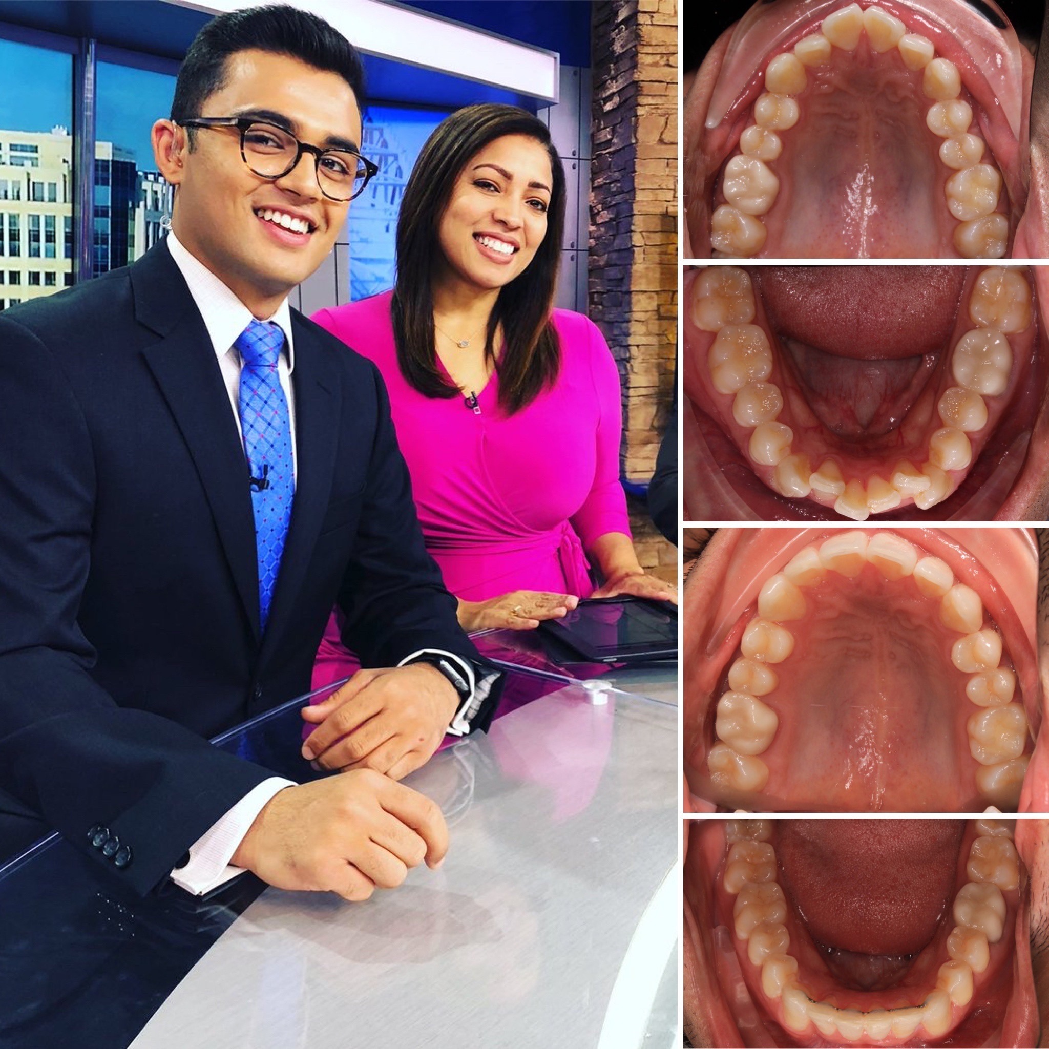 patient before and after photo