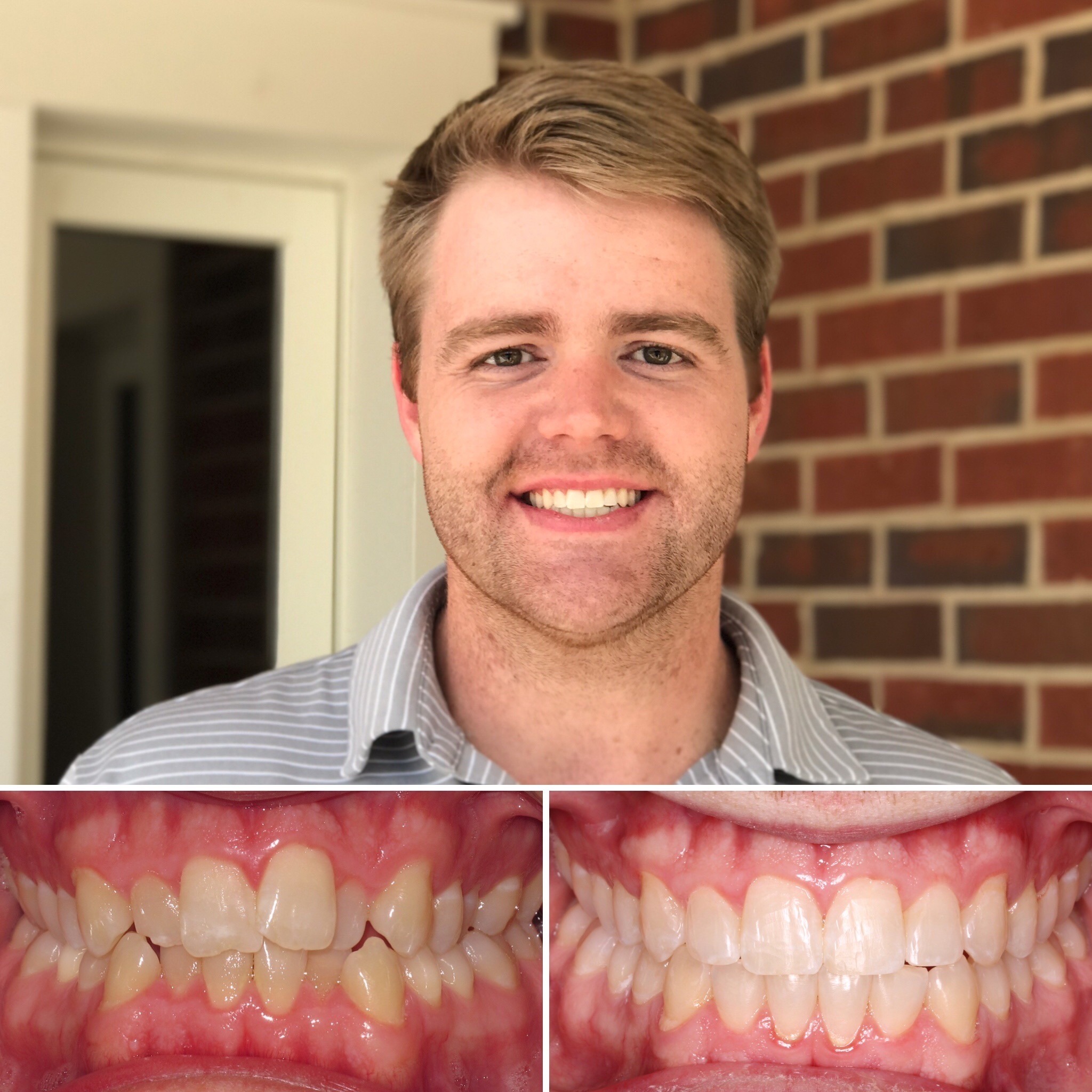patient before and after photo