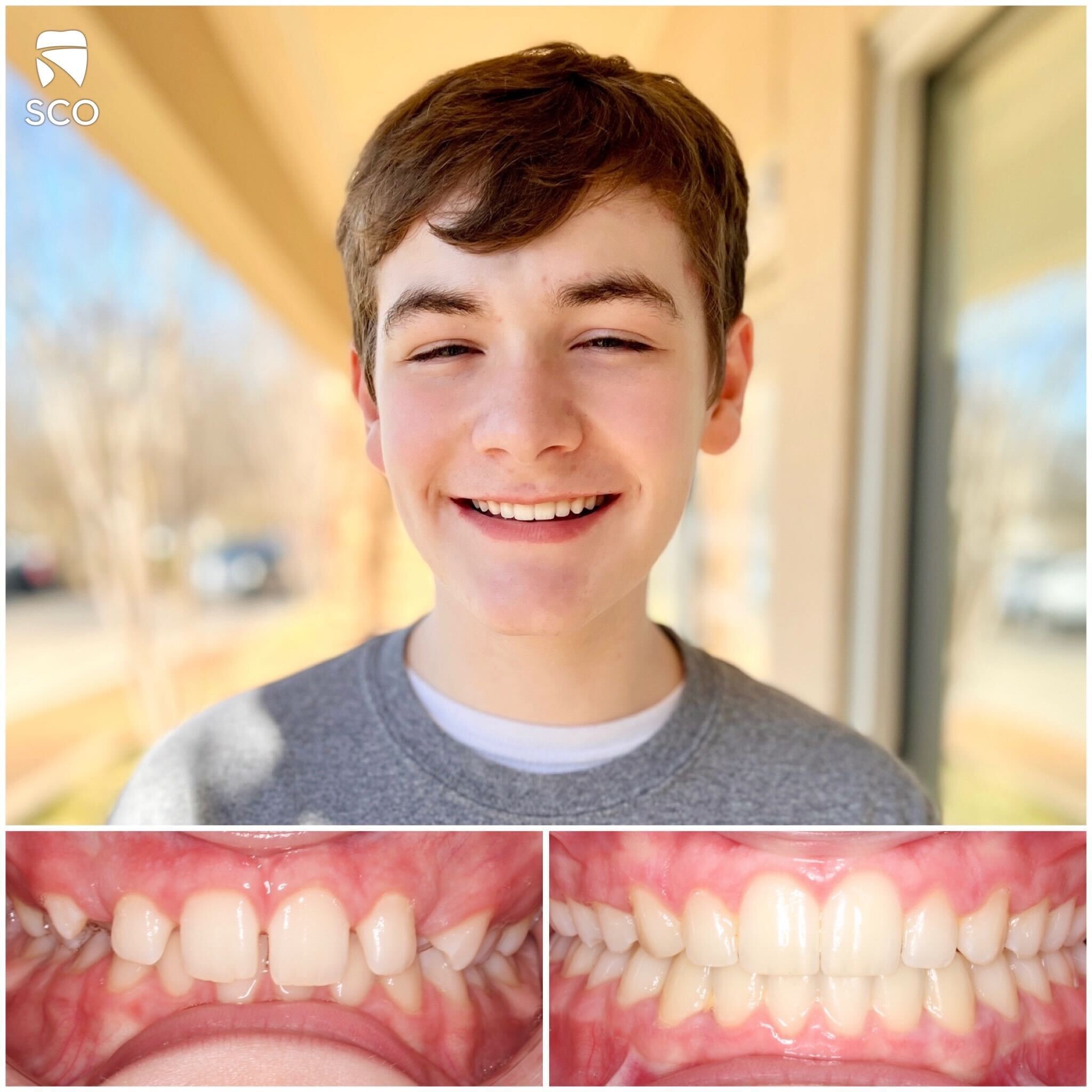 patient before and after photo