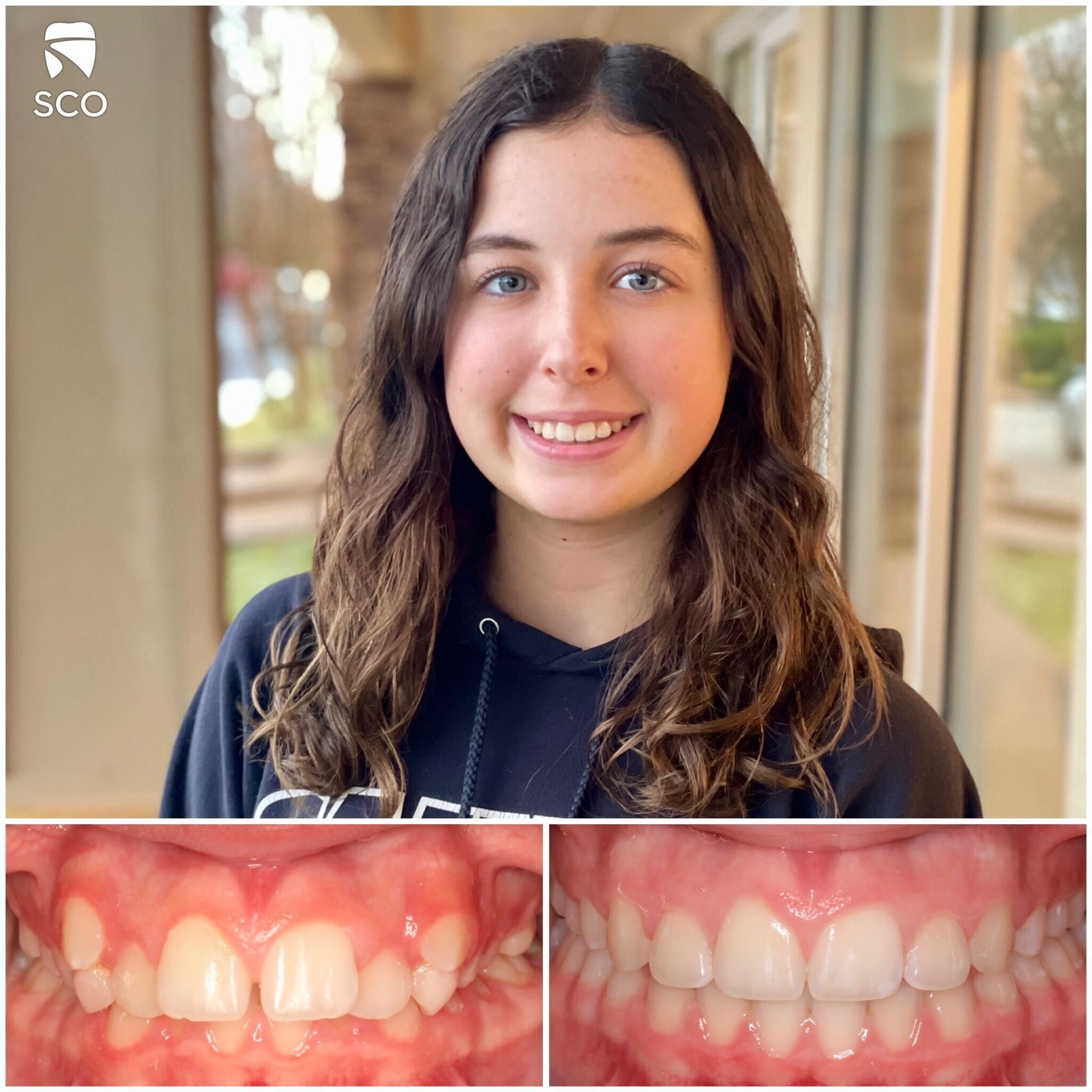 patient before and after photo