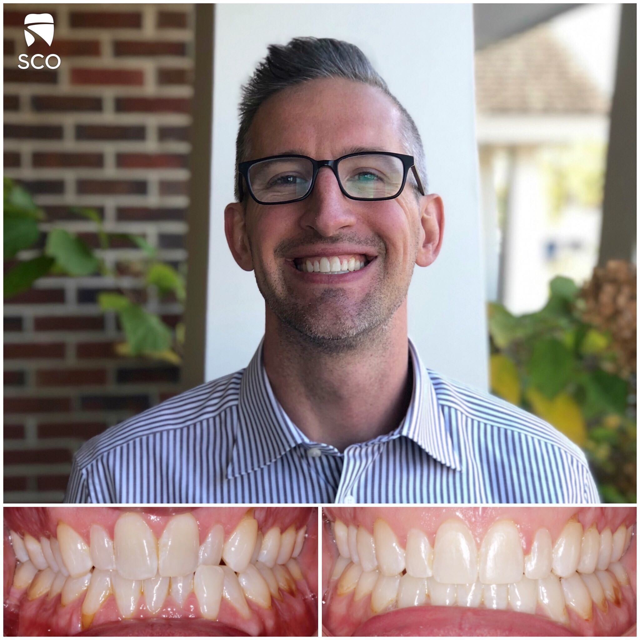 patient before and after photo