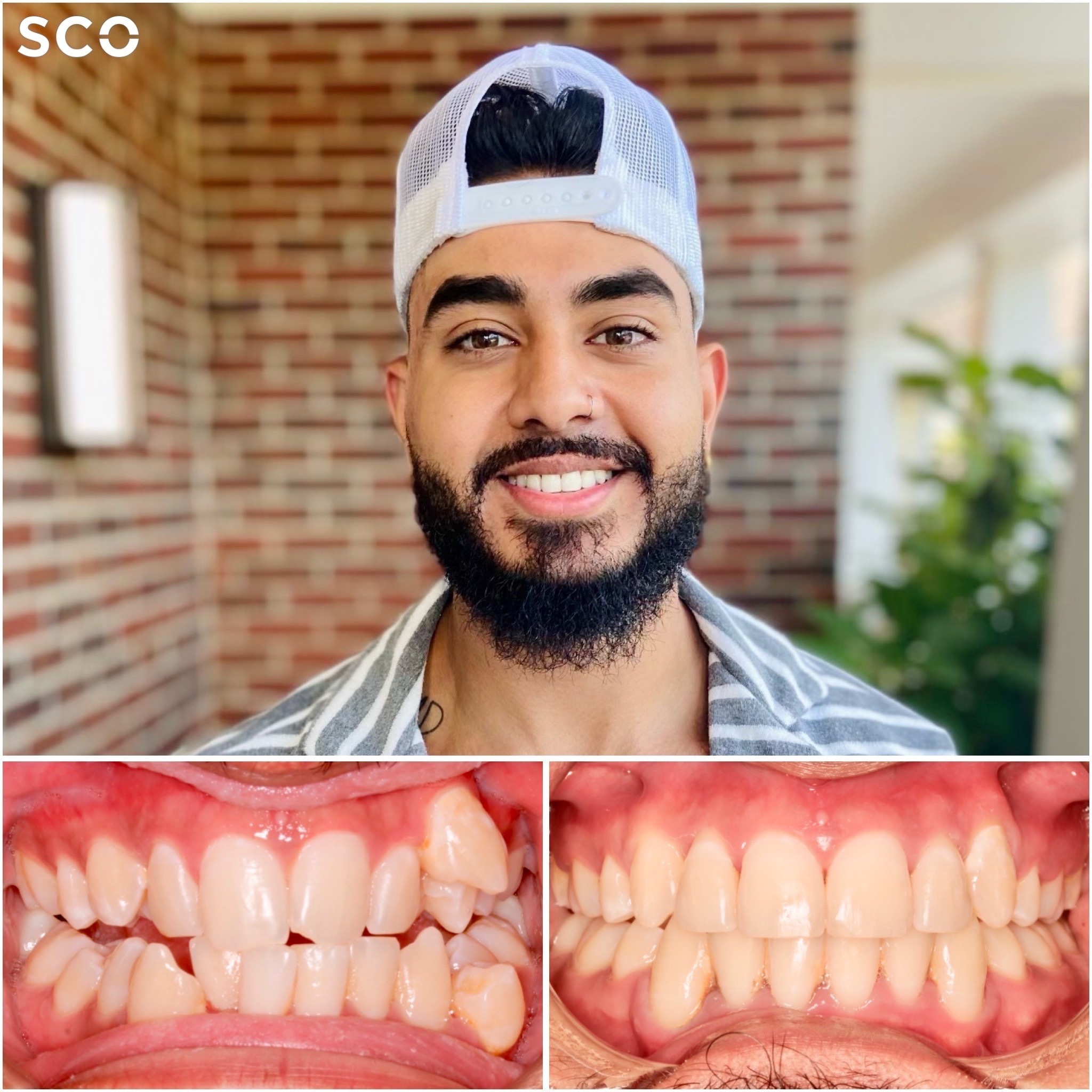 patient before and after photo