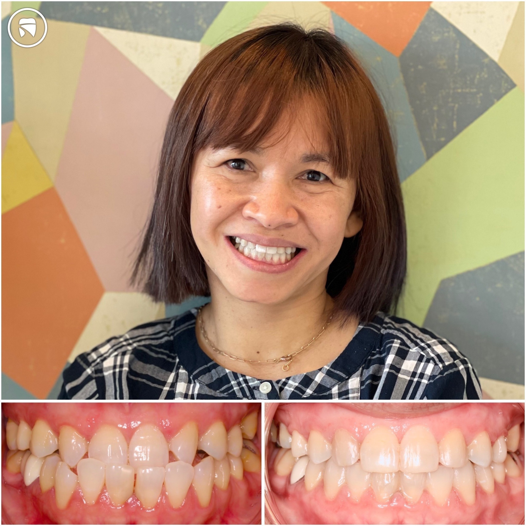 patient before and after photo