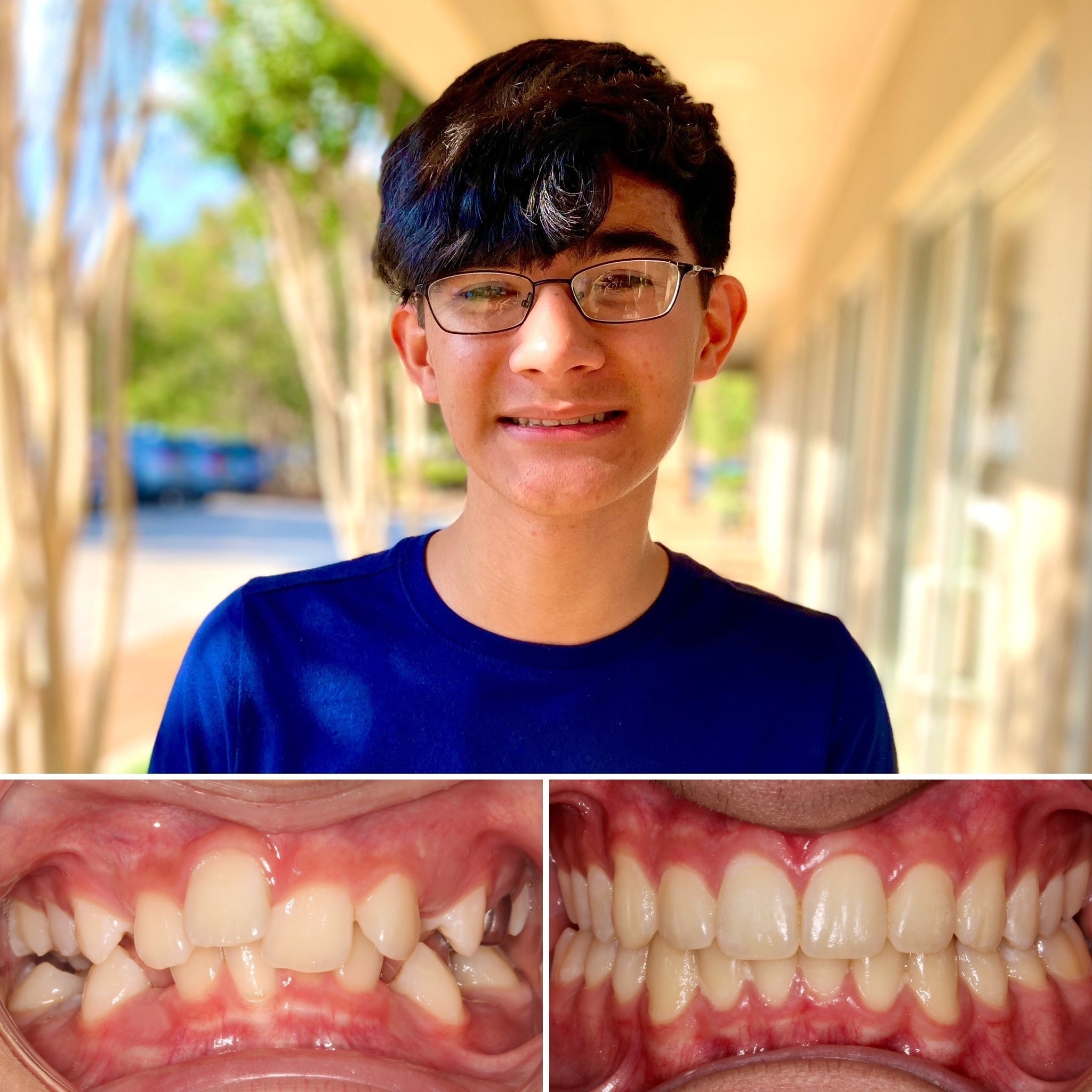 patient before and after photo