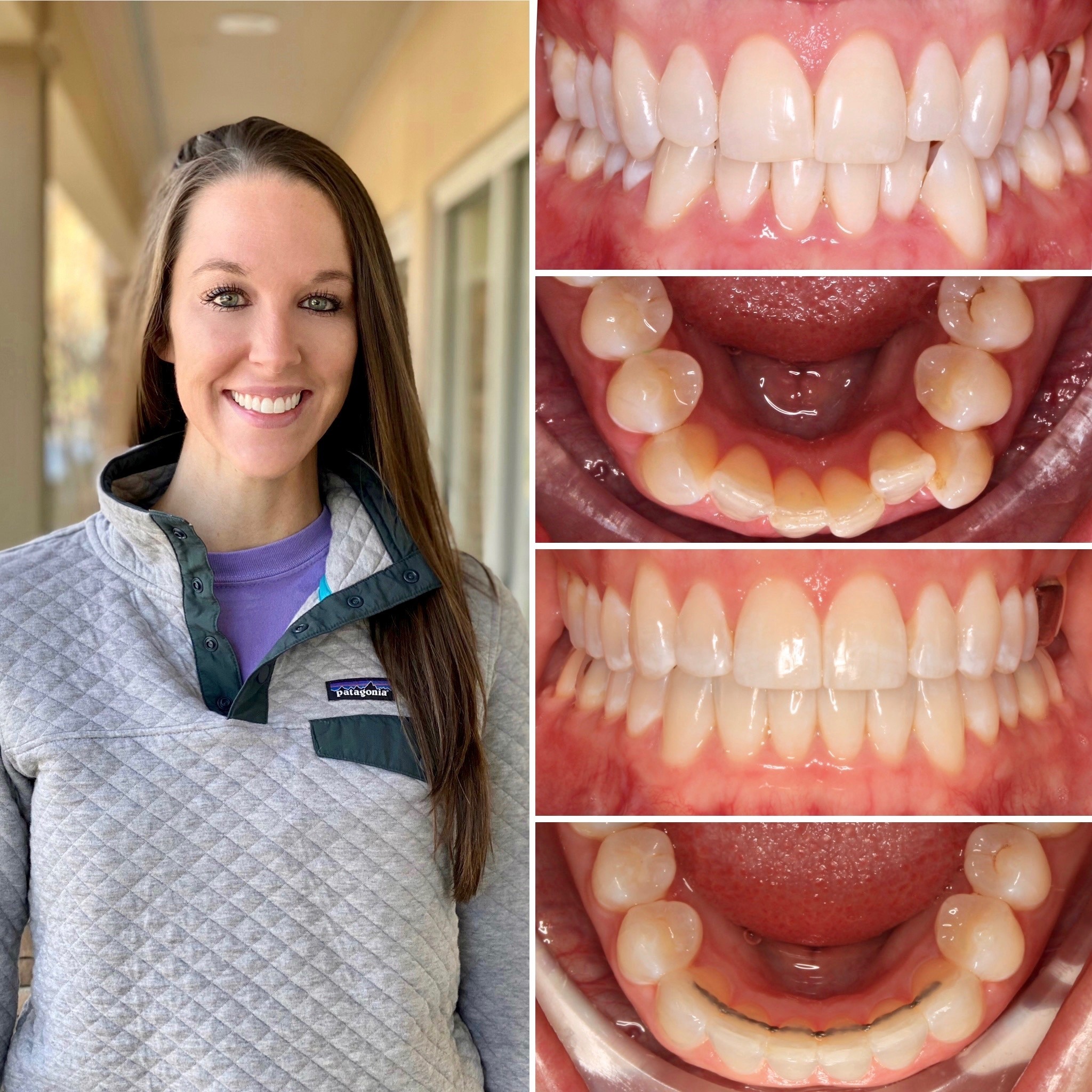 patient before and after photo